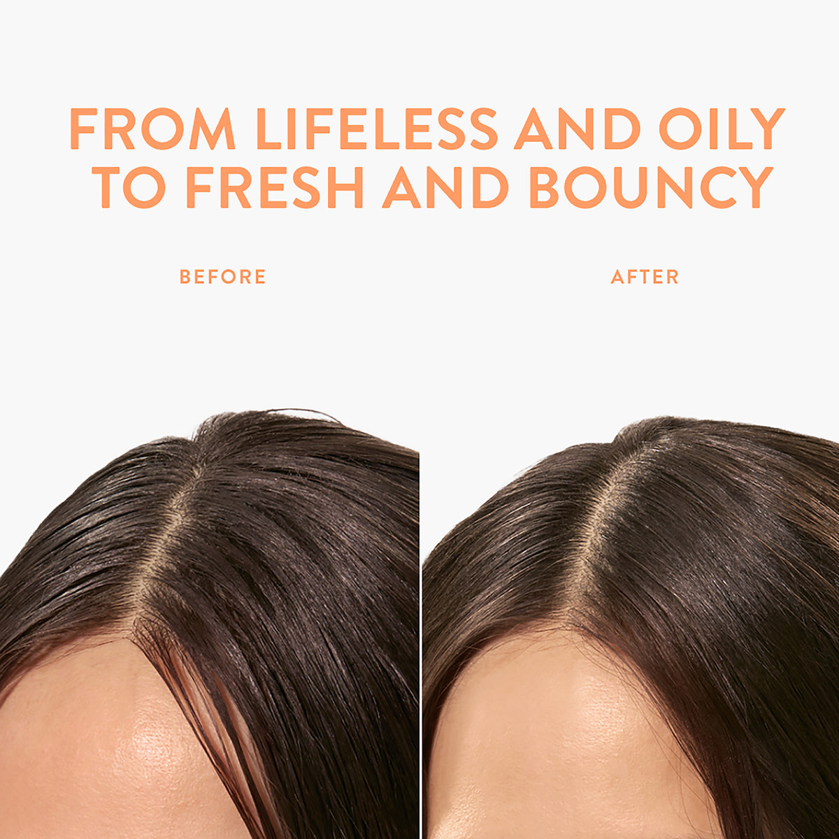Dry Shampoo