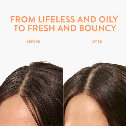 Dry Shampoo